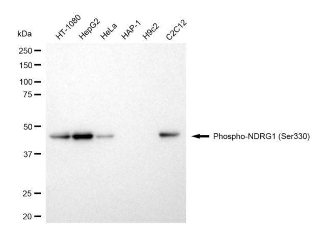 Phospho-NDRG1 (Ser330) Antibody in Western Blot (WB)