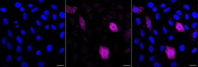 Phospho-PLCB3 (Ser537) Antibody in Immunocytochemistry (ICC/IF)