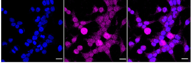 Phospho-Presenilin 1 (Ser310) Antibody in Immunocytochemistry (ICC/IF)