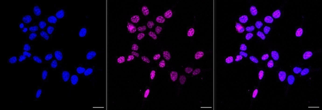 Phospho-RAD17 (Ser656) Antibody in Immunocytochemistry (ICC/IF)