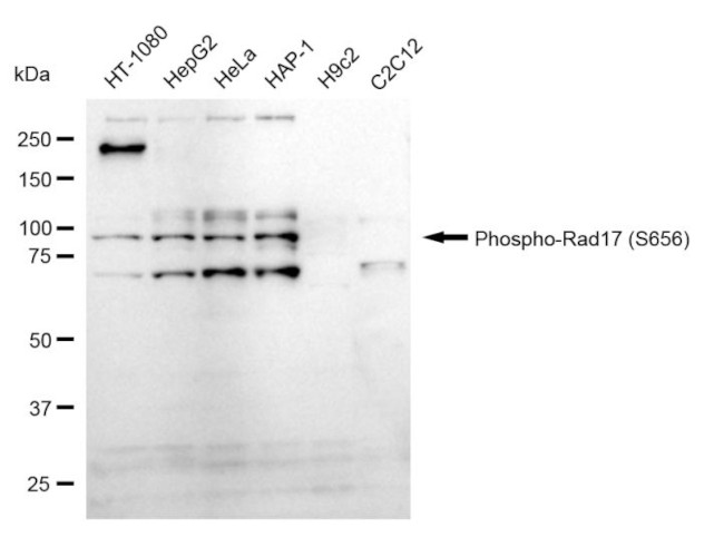 Phospho-RAD17 (Ser656) Antibody in Western Blot (WB)