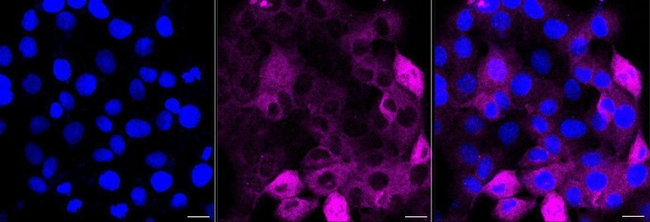 CALM Antibody in Immunocytochemistry (ICC/IF)