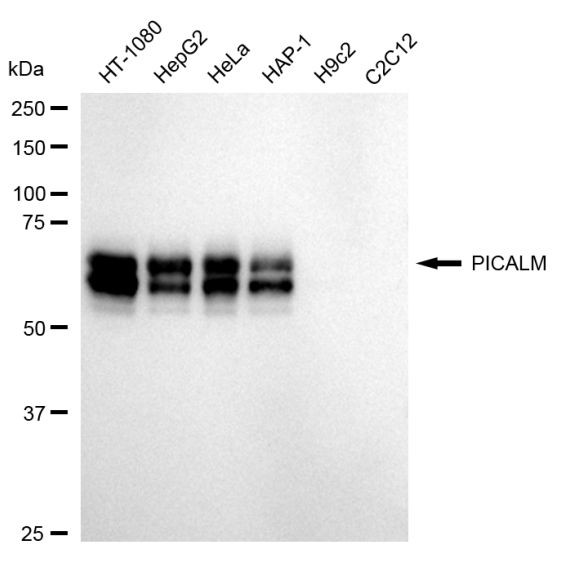 CALM Antibody in Western Blot (WB)