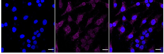 VPS34 Antibody in Immunocytochemistry (ICC/IF)