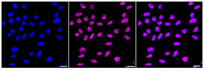 PABPN1 Antibody in Immunocytochemistry (ICC/IF)