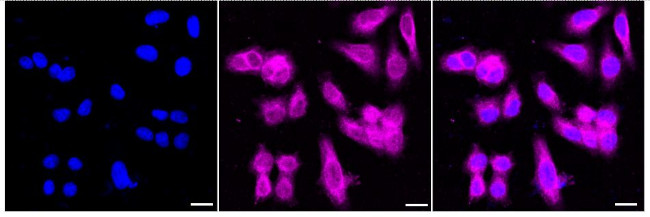 PPP2R5E Antibody in Immunocytochemistry (ICC/IF)