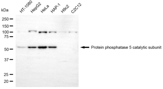 PP5 Antibody in Western Blot (WB)