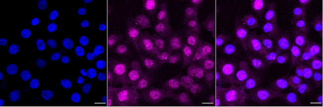 Presenilin 1 Antibody in Immunocytochemistry (ICC/IF)