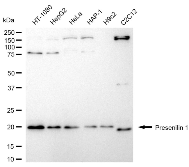 Presenilin 1 Antibody in Western Blot (WB)