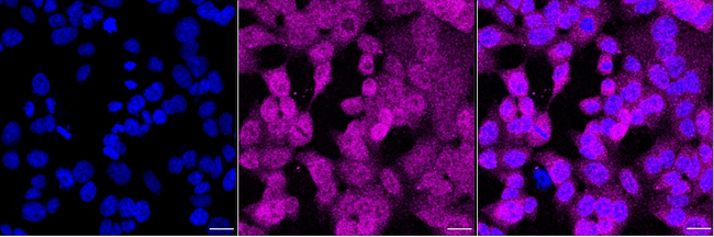 PRKAR2A Antibody in Immunocytochemistry (ICC/IF)