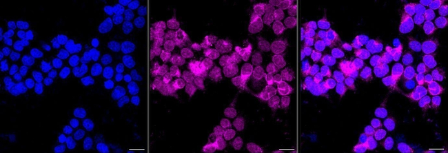 PRKCSH Antibody in Immunocytochemistry (ICC/IF)