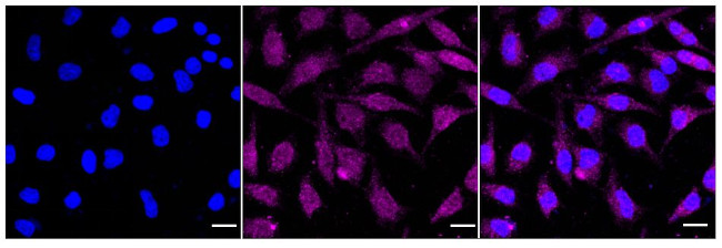 PRMT5 Antibody in Immunocytochemistry (ICC/IF)