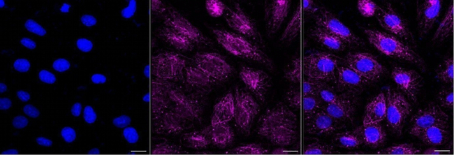 PRMT6 Antibody in Immunocytochemistry (ICC/IF)