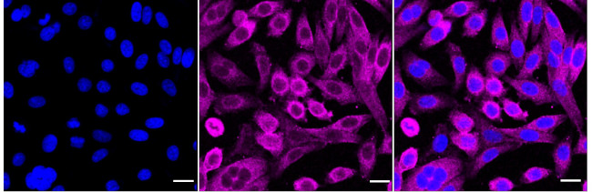 PAR4 Antibody in Immunocytochemistry (ICC/IF)
