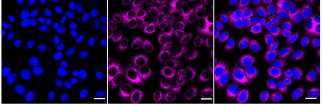 PDI Antibody in Immunocytochemistry (ICC/IF)