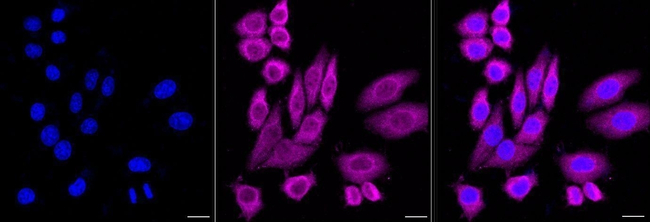 p23 Antibody in Immunocytochemistry (ICC/IF)
