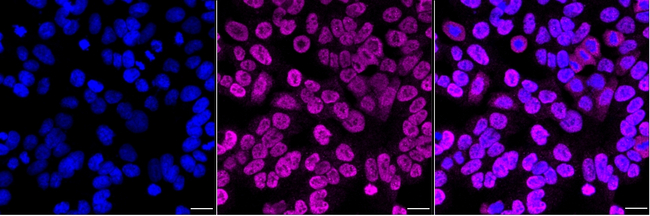 PTBP1 Antibody in Immunocytochemistry (ICC/IF)