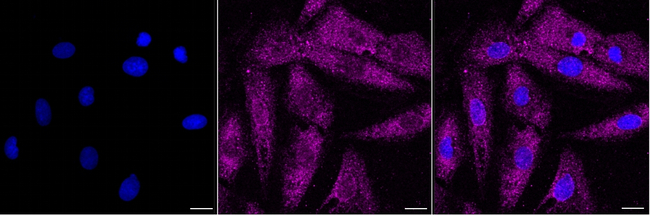 PUM2 Antibody in Immunocytochemistry (ICC/IF)