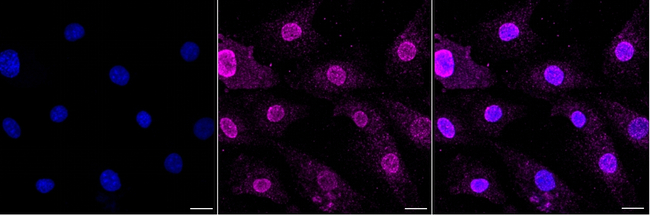 PDK1 Antibody in Immunocytochemistry (ICC/IF)
