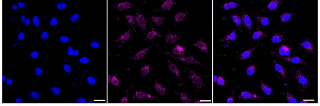 Rab4 Antibody in Immunocytochemistry (ICC/IF)