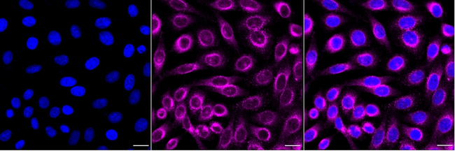 RAB5 Antibody in Immunocytochemistry (ICC/IF)