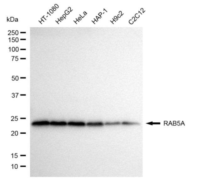 RAB5 Antibody in Western Blot (WB)