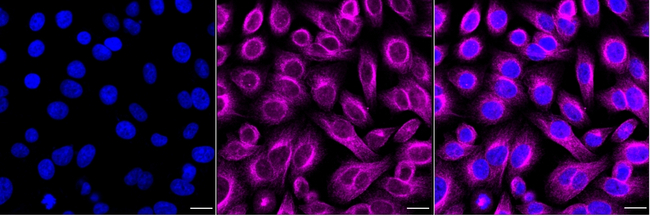 RAB5 Antibody in Immunocytochemistry (ICC/IF)