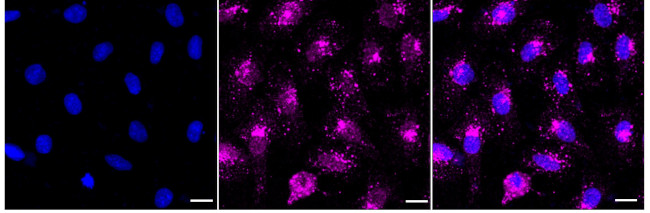 RAB7 Antibody in Immunocytochemistry (ICC/IF)
