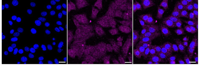 RAD21 Antibody in Immunocytochemistry (ICC/IF)