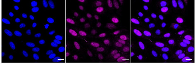 RAD23A Antibody in Immunocytochemistry (ICC/IF)