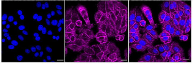 Radixin Antibody in Immunocytochemistry (ICC/IF)