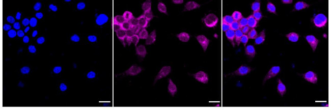 RALBP1 Antibody in Immunocytochemistry (ICC/IF)