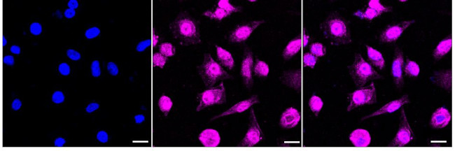 RAVER2 Antibody in Immunocytochemistry (ICC/IF)