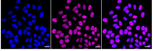 RbAp48 Antibody in Immunocytochemistry (ICC/IF)