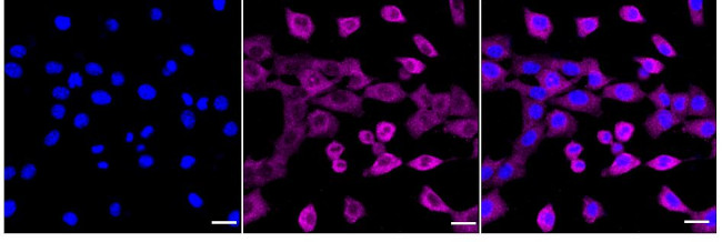 RelB Antibody in Immunocytochemistry (ICC/IF)