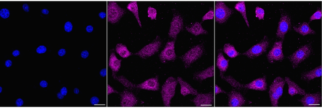 RelB Antibody in Immunocytochemistry (ICC/IF)