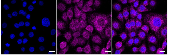 RARA Antibody in Immunocytochemistry (ICC/IF)