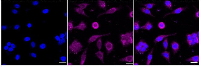 RARB Antibody in Immunocytochemistry (ICC/IF)