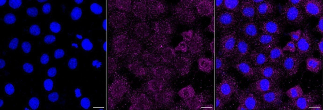 Ribophorin I Antibody in Immunocytochemistry (ICC/IF)