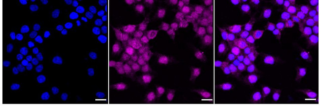 RPS6KB2 Antibody in Immunocytochemistry (ICC/IF)