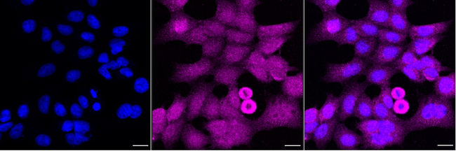 RPS6KB2 Antibody in Immunocytochemistry (ICC/IF)