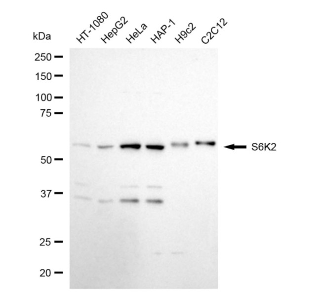 RPS6KB2 Antibody in Western Blot (WB)