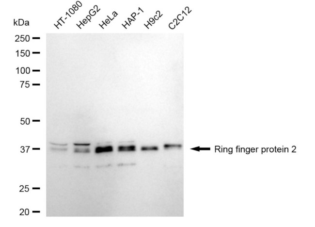RNF2 Antibody in Western Blot (WB)