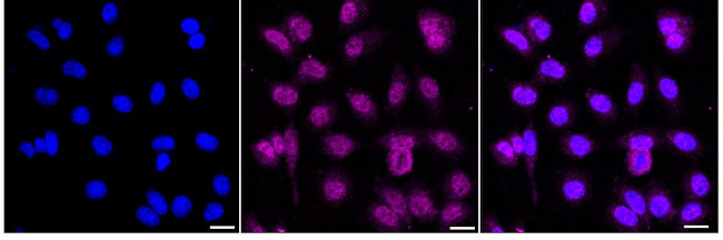 RNF40 Antibody in Immunocytochemistry (ICC/IF)