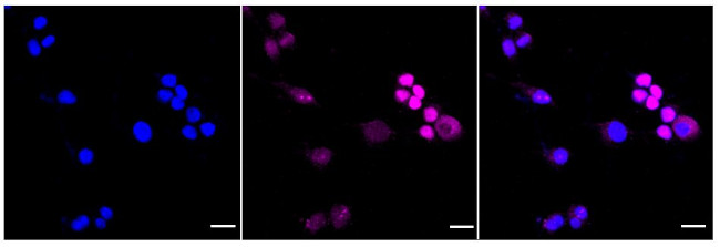 SAMHD1 Antibody in Immunocytochemistry (ICC/IF)