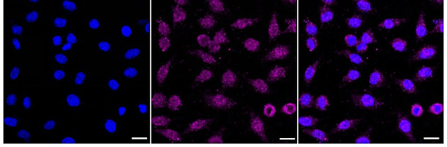 SAMM50 Antibody in Immunocytochemistry (ICC/IF)