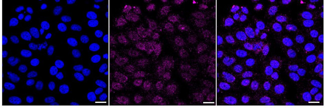SR-BI Antibody in Immunocytochemistry (ICC/IF)