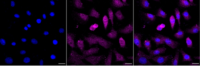 Septin 2 Antibody in Immunocytochemistry (ICC/IF)