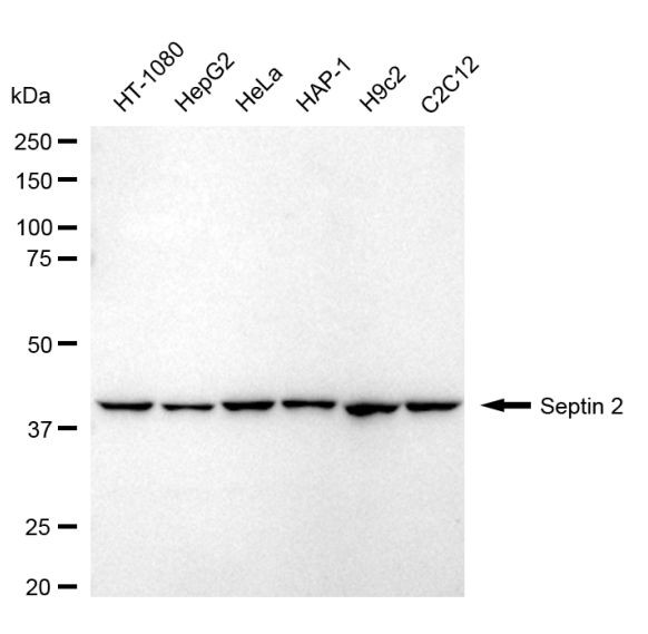 Septin 2 Antibody in Western Blot (WB)