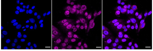 Serine racemase Antibody in Immunocytochemistry (ICC/IF)